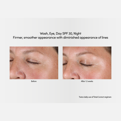 Firmer, smoother appearance with diminishes appearance of lines after using Age Reverse Day Repair SPF 30 Face Cream with Retinol 50g