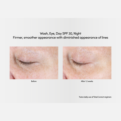 Firmer, smoother appearance with diminished appearance of lines after using Age Reverse Day Repair SPF 30 Face Cream with Retinol  50g