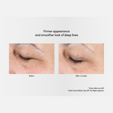 Firmer appearance and smoother look of deep lines after using Exuviance-R Total Correct+Sculpt Serum