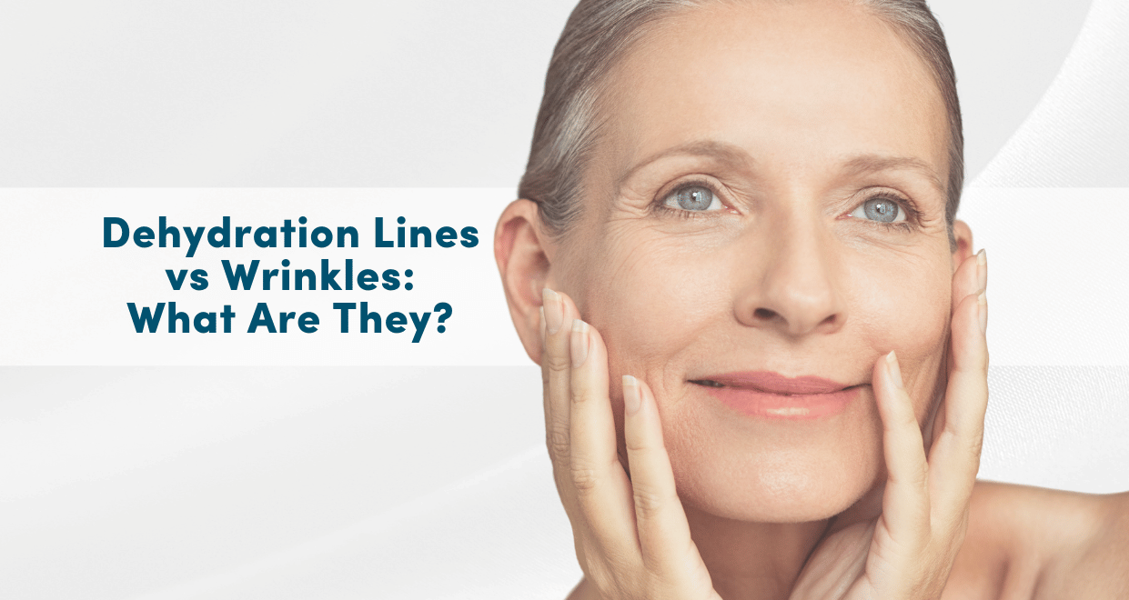 Dehydration Lines vs Wrinkles: How to Tell the Difference