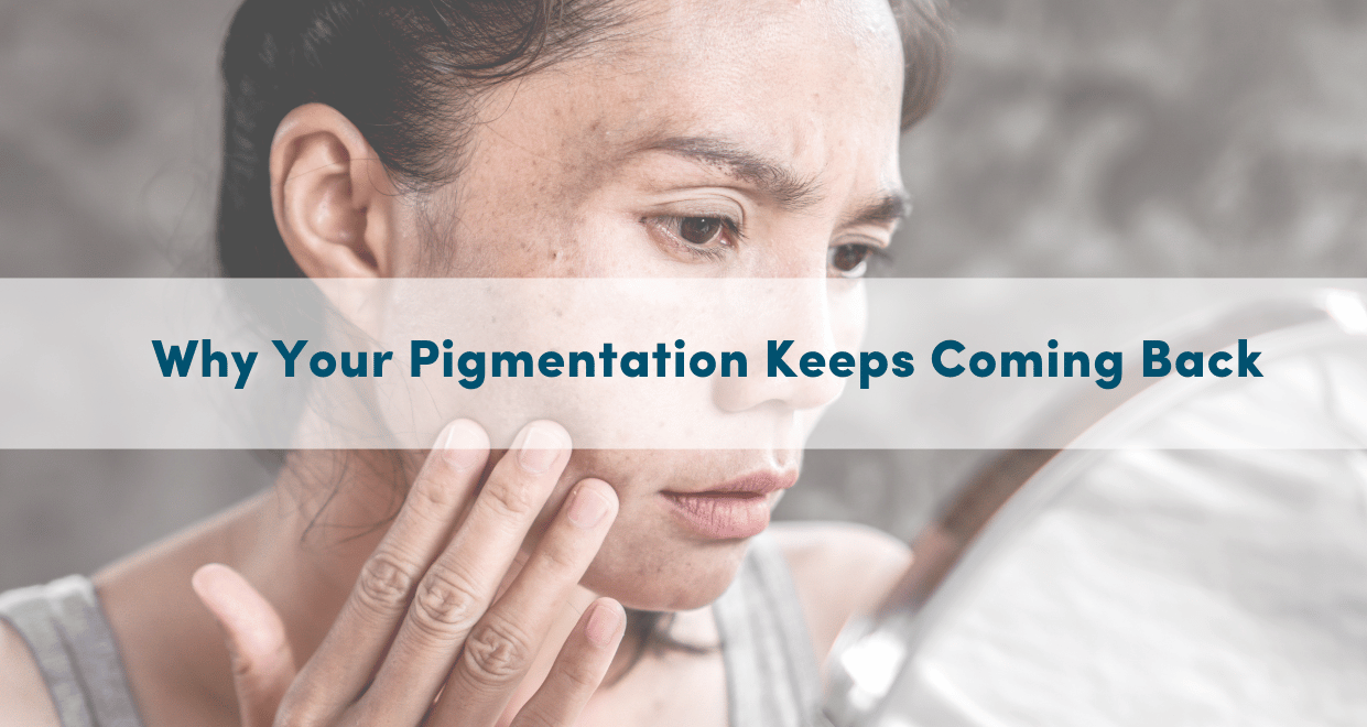 Why Your Pigmentation Keeps Coming Back