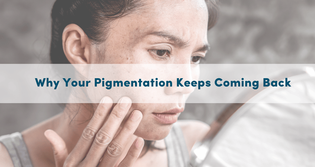 Why Your Pigmentation Keeps Coming Back