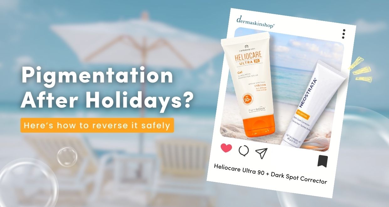 Pigmentation After Holidays? Here’s How to Reverse It Safely